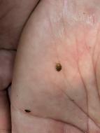 ルイスツブゲンゴロウ